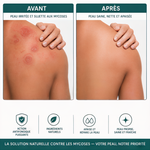 Savon Purifiant Intensif & Antifongique Naturel